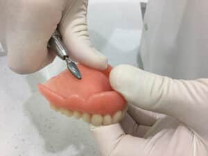 Read more about the article What is a denture reline?