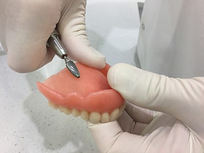 Denture Relines side image