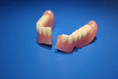 Read more about the article Broken Dentures? Understanding the Why and How of Broken Denture Repair