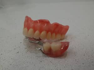 Partial denture solution at Advance oral dentures