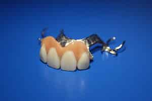 Read more about the article Artificial teeth: bringing your smile back to life