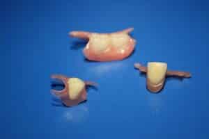 Read more about the article Can one tooth be replaced?