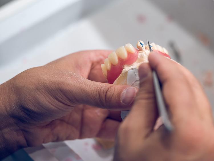 Choosing partial dentures with the help of our team- Mobile denture service in Maroochydore