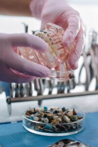 Read more about the article Dentures 101 Vol.2: FAQ answered