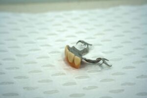 Read more about the article How often should you visit a denture clinic?