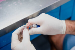 Read more about the article Single Tooth Denture