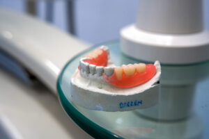 Read more about the article Partials for back teeth