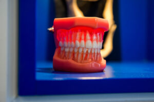 new dentures advance oral dentures sunshine coast