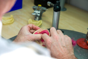 Read more about the article What to do after losing a tooth
