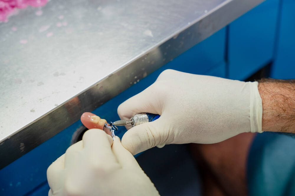 partial dentures on the sunshine coast