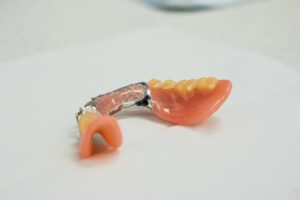 Read more about the article How long do dentures last?