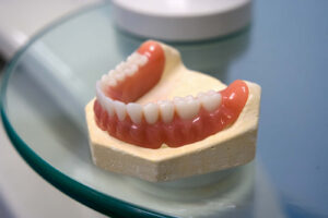 Read more about the article What are acrylic dentures?