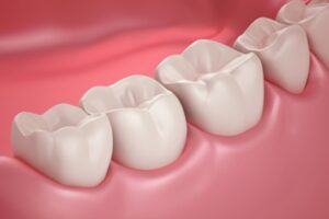 Read more about the article Do you need a partial denture for back molar?